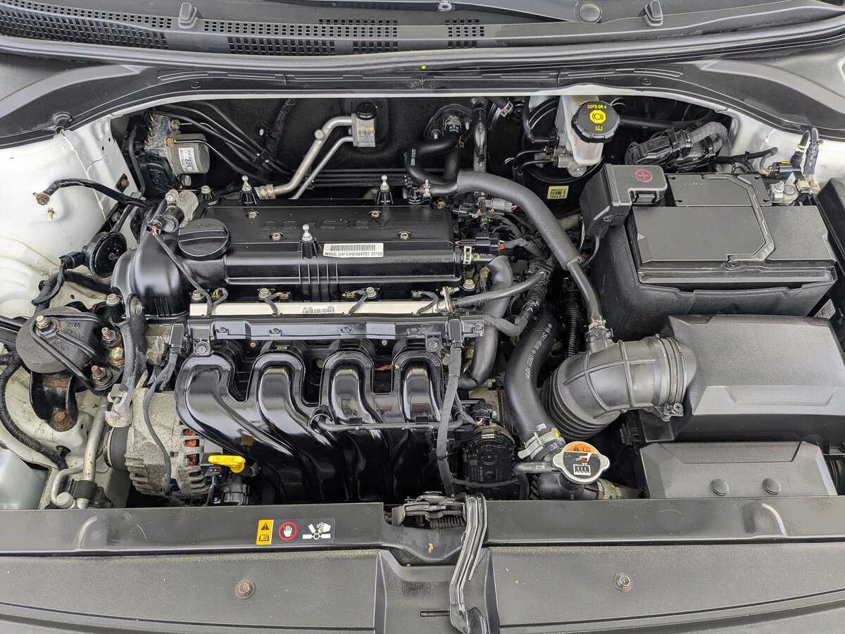 Б/У Хендай Солярис 2017 года. Фото: #8